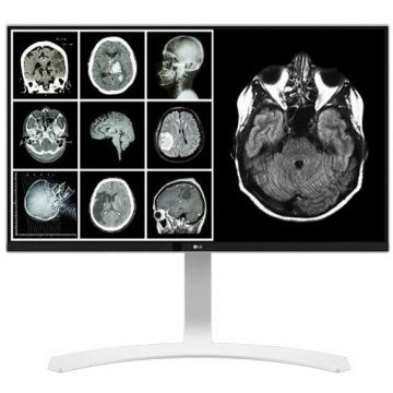Monitor LED LG Clinical Review 27HJ712C-W 27 inch 14 ms Argintiu DICOM 60 Hz