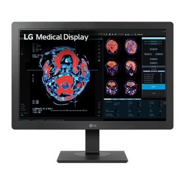 Monitor LG 24
