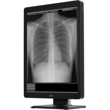 Monitor Diagnostic MS-S300 21.3inch Black White