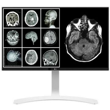 Lg Monitor LED LG Clinical Review 27HJ712C-W 27 inch 14 ms, DICOM 60 Hz, Argintiu